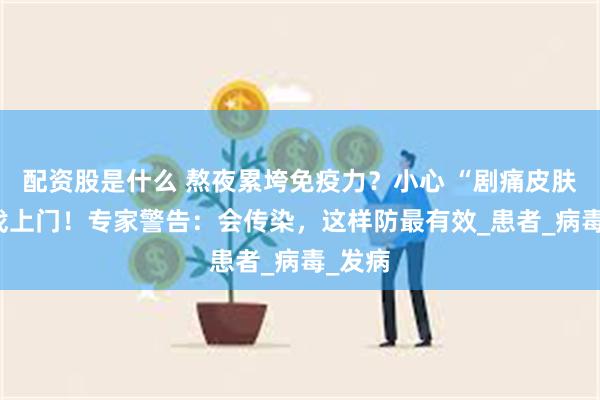 配资股是什么 熬夜累垮免疫力？小心 “剧痛皮肤病” 找上门！专家警告：会传染，这样防最有效_患者_病毒_发病